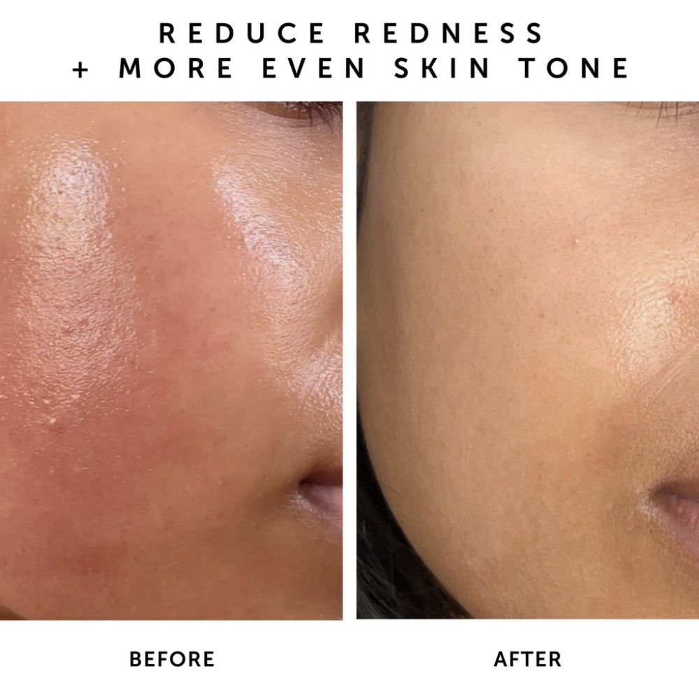 Herbivore - NOVA 15% Vitamin C + Turmeric Brightening Serum - Picture 3 of 6
